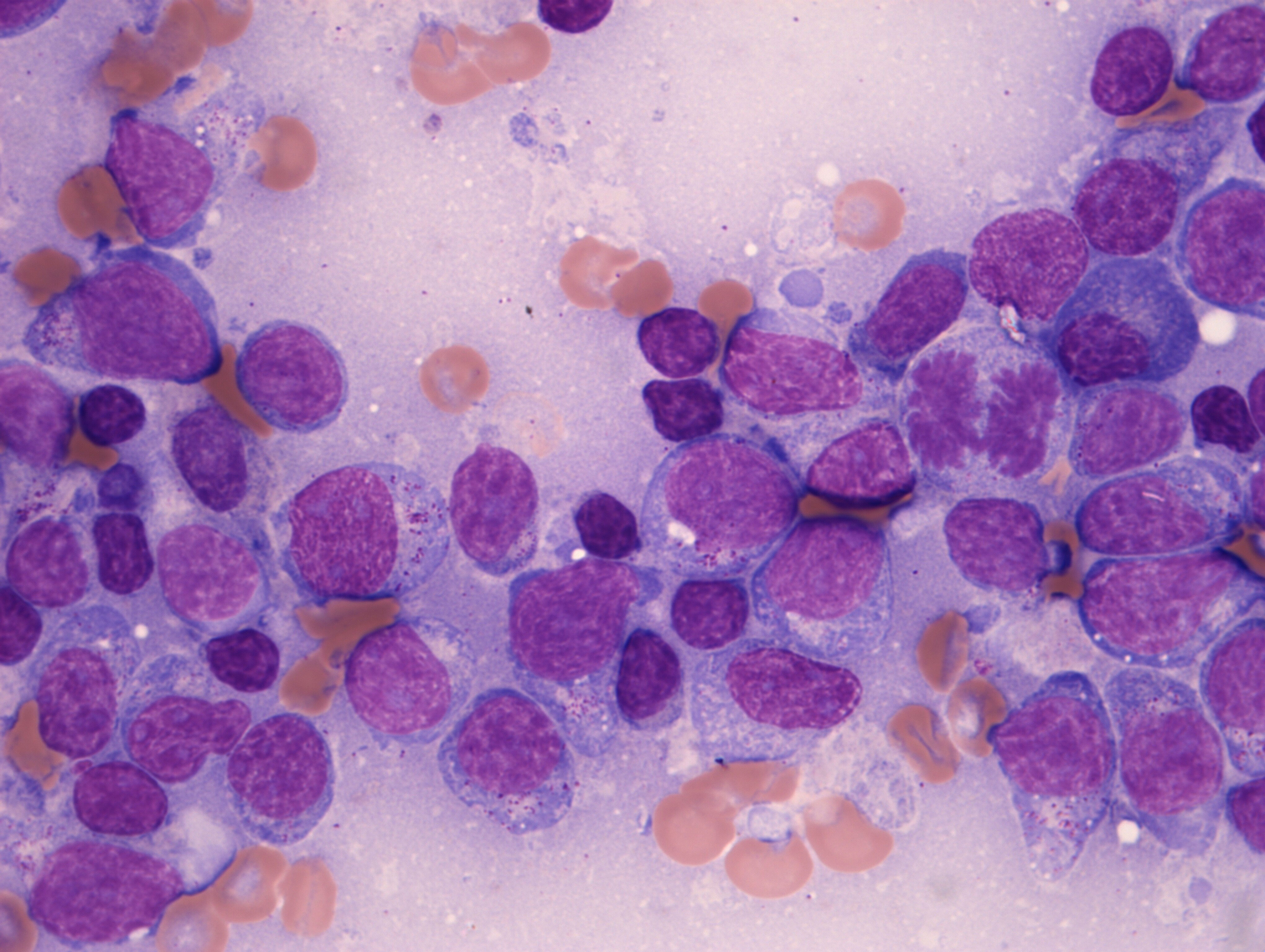 purple stained cells on a background of paler lilac purple stained cells on a background of paler lilac